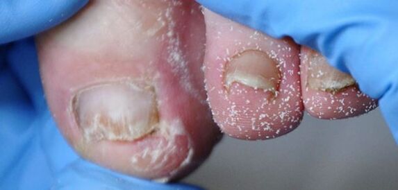 Cogumelos de levedura