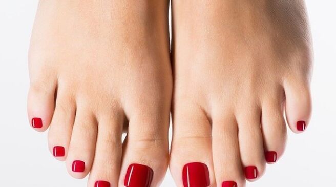 Tratamento a laser de fungo das unhas